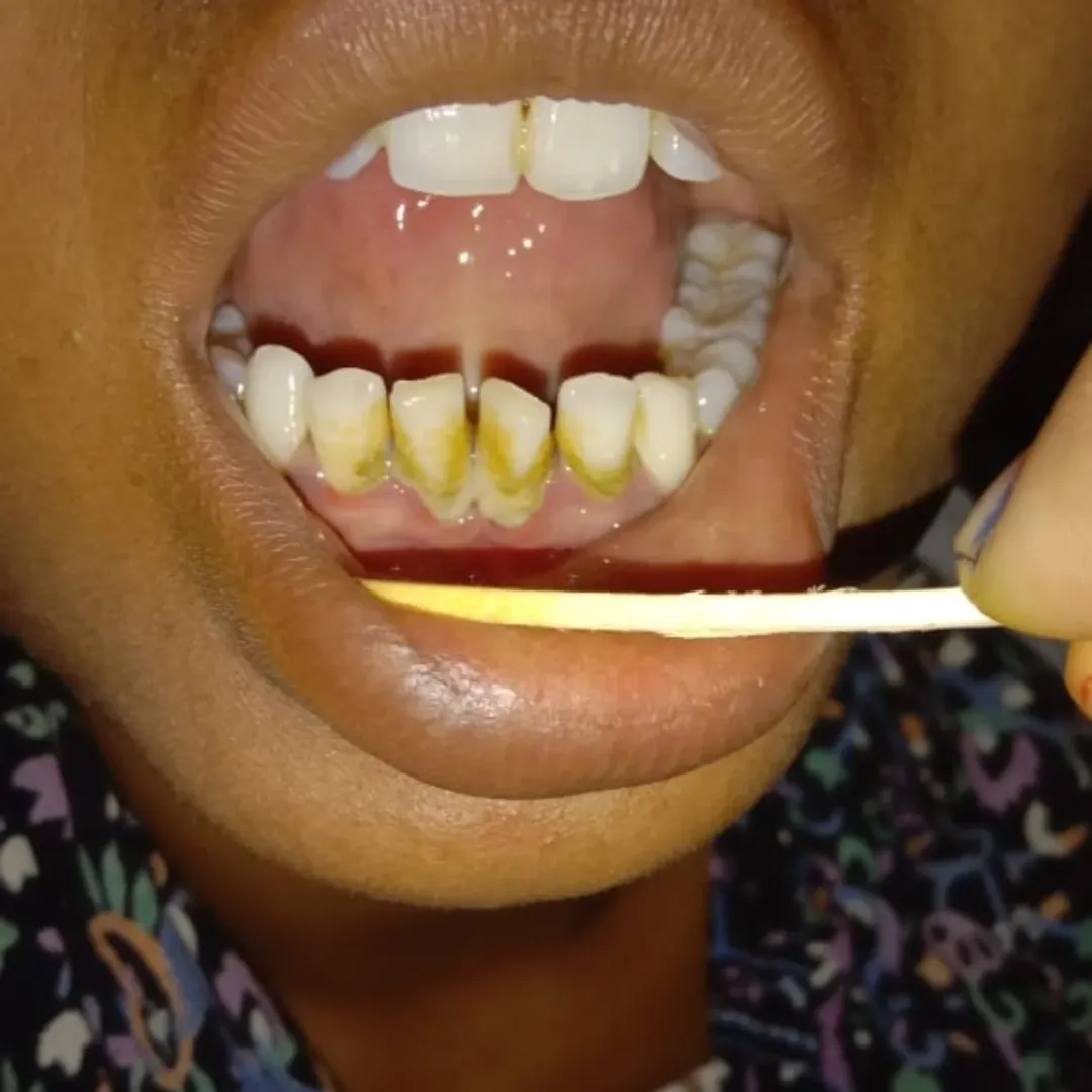 Maternal health awareness